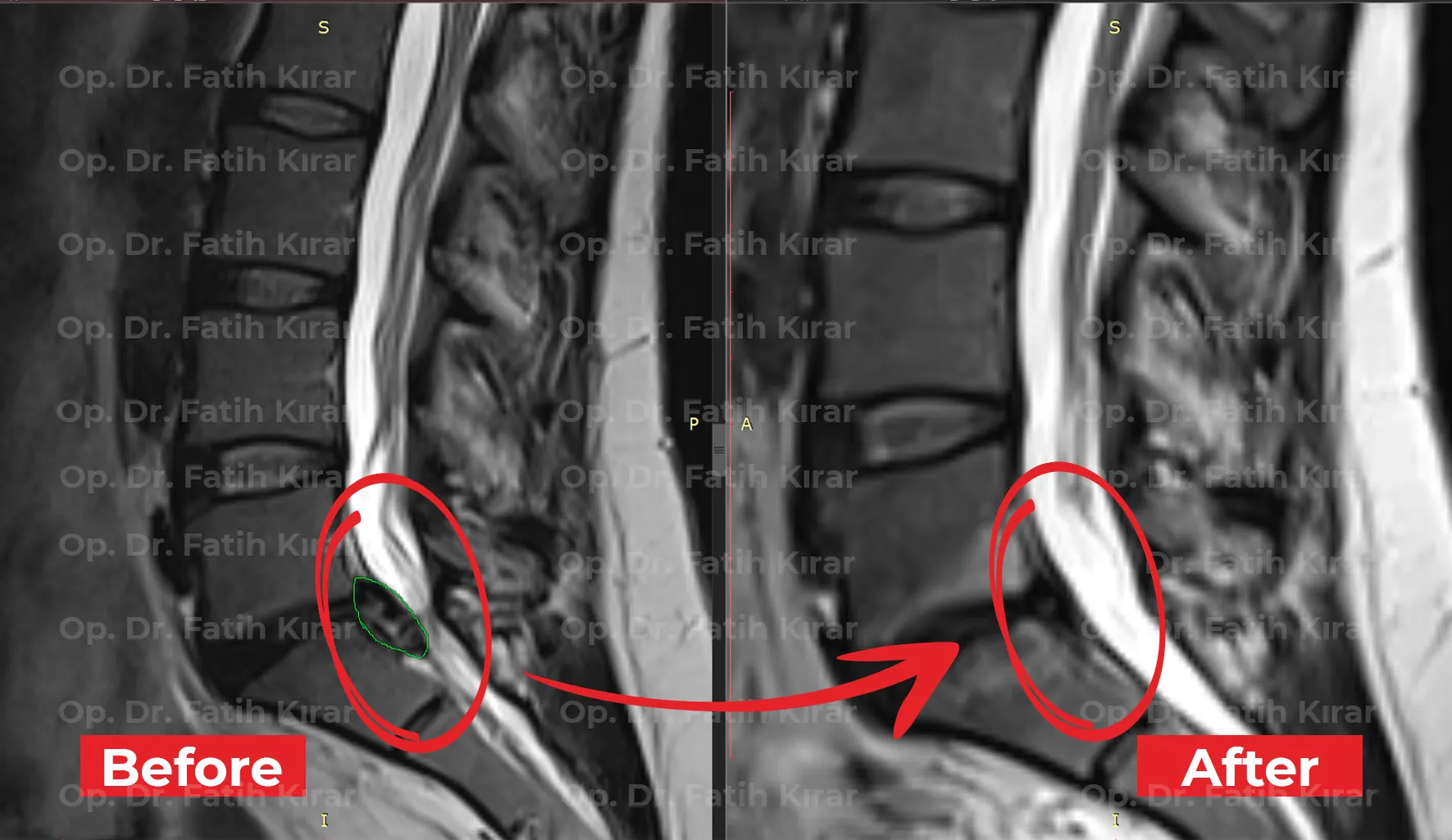 MRI image 3